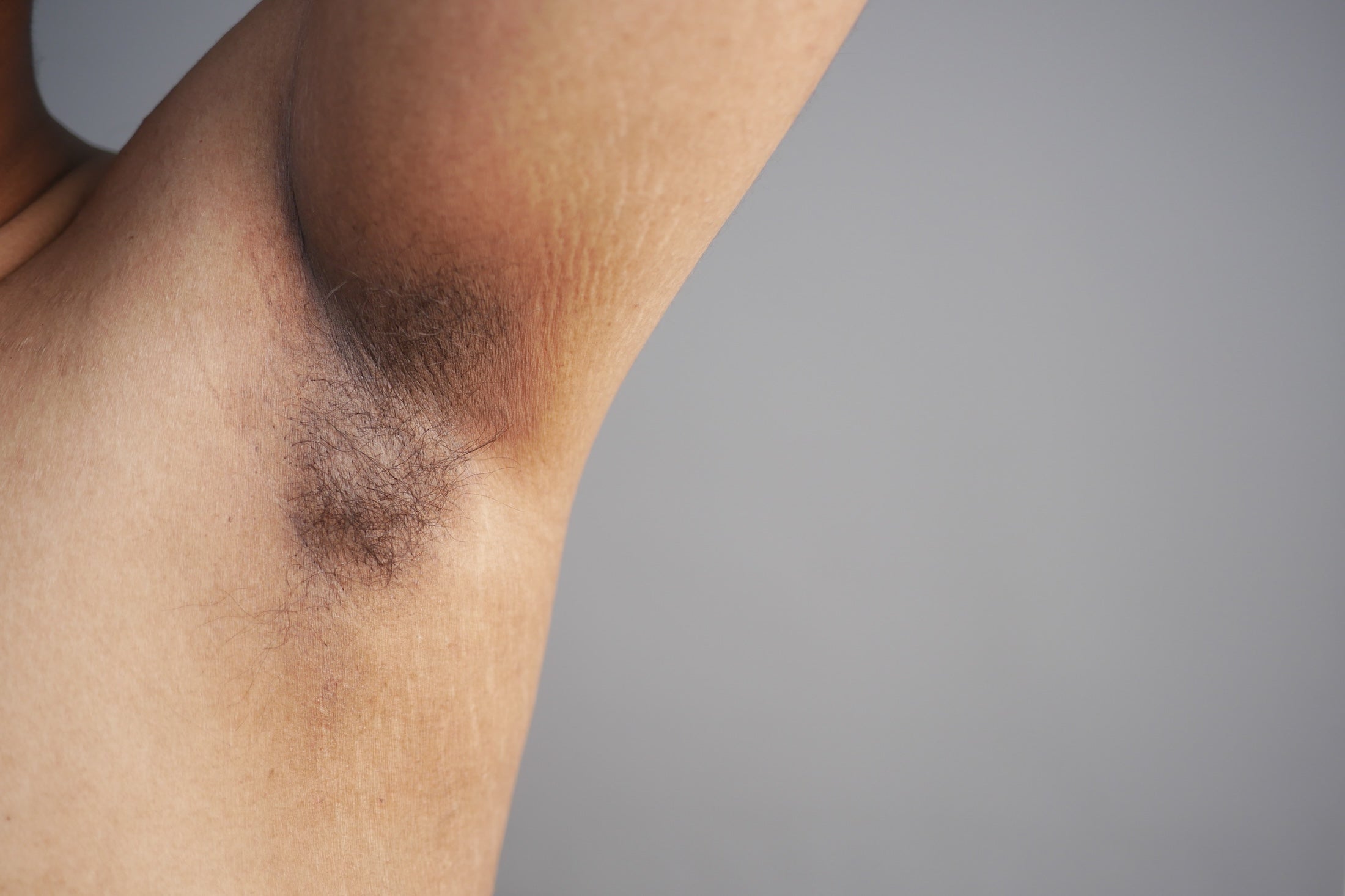 Rasage sous les bras : éviter irritations et poils incarnés